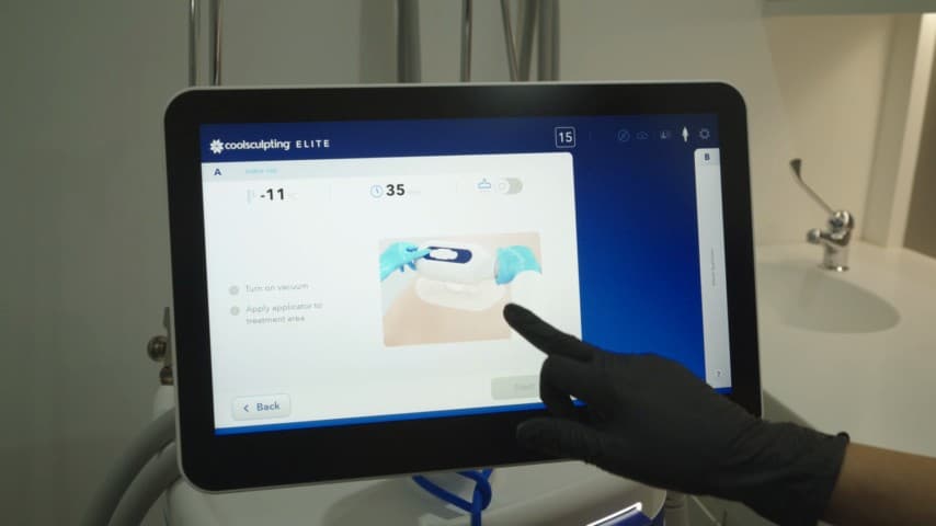 CoolSculpting Elite fat freezing device at Berkshire Aesthetics
