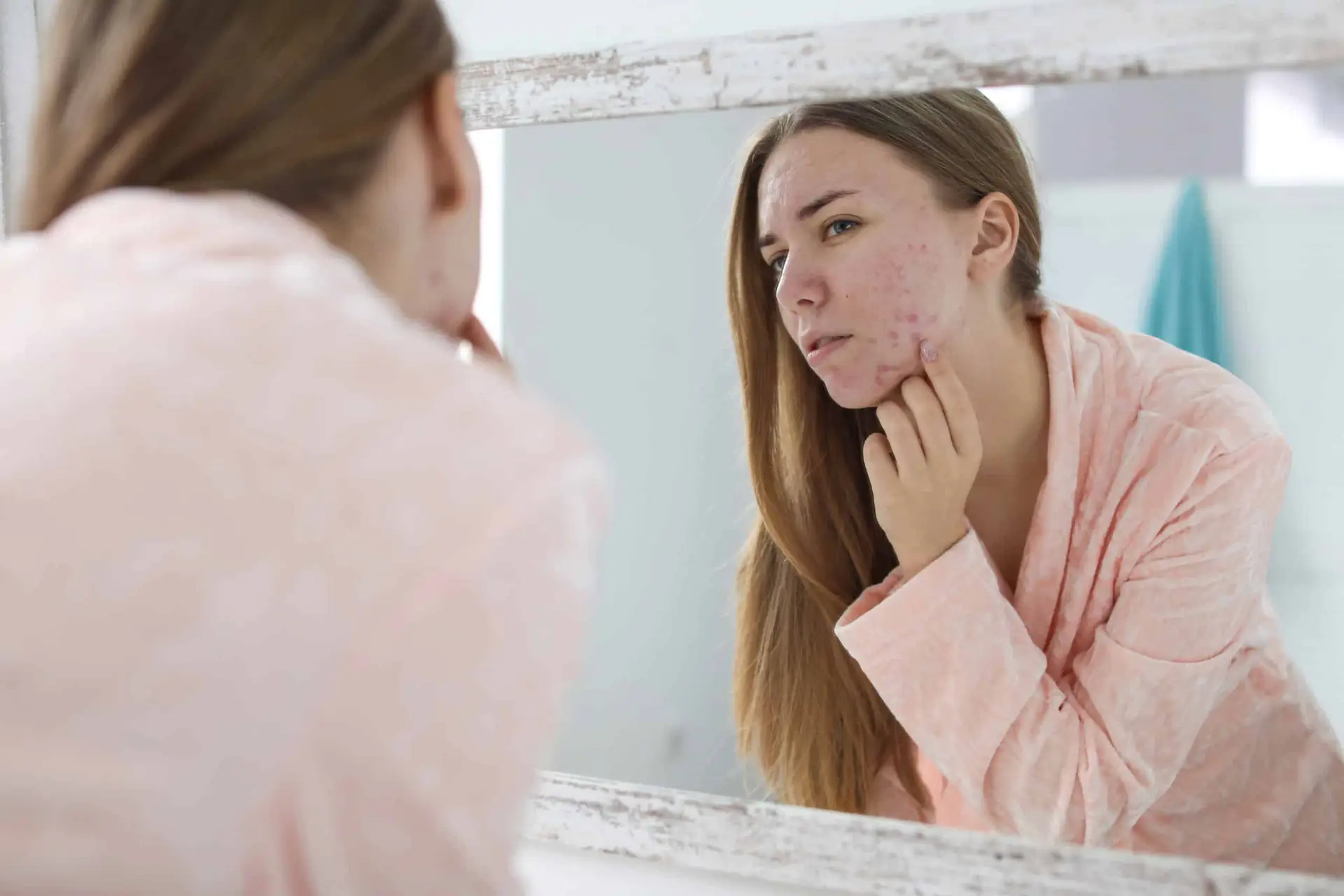 Young woman examining acne breakouts in the mirror