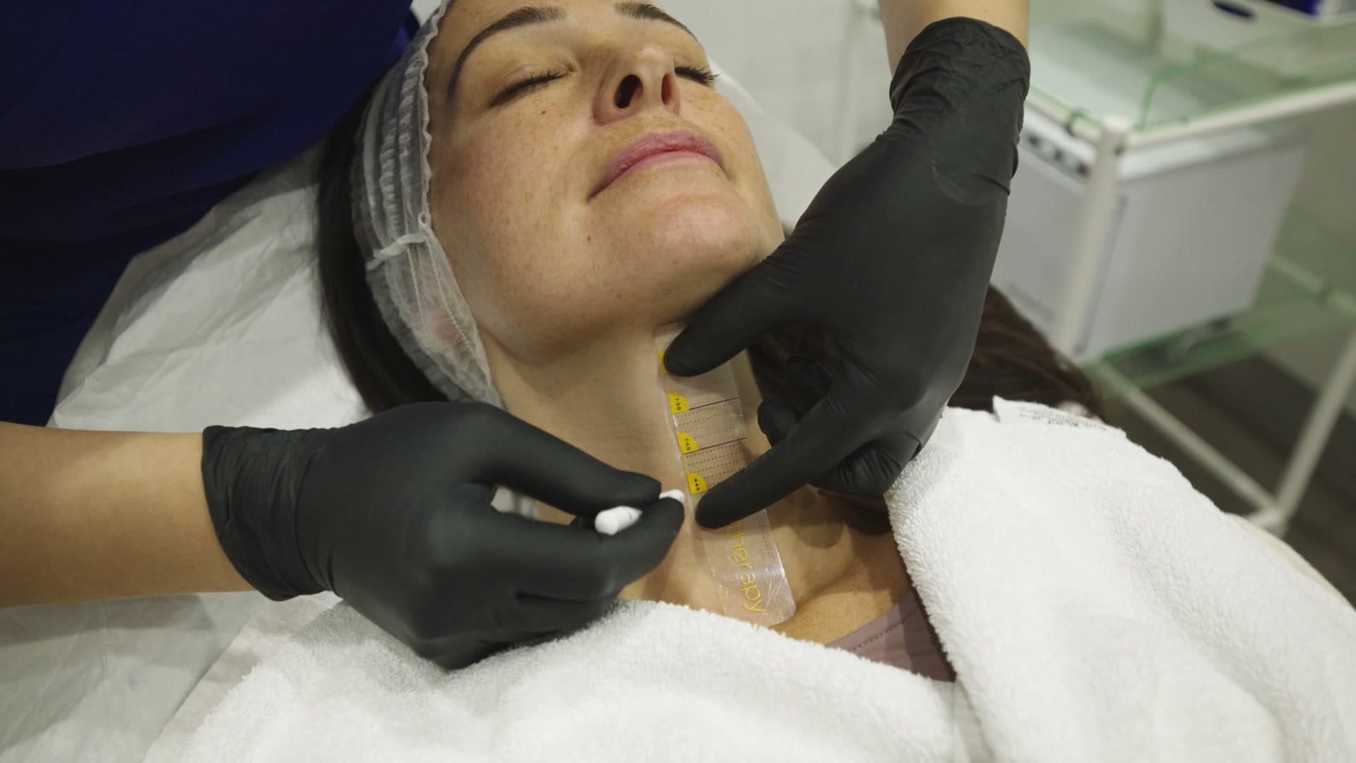 Ultherapy treatment planning on the jawline at Berkshire Aesthetics in Maidenhead