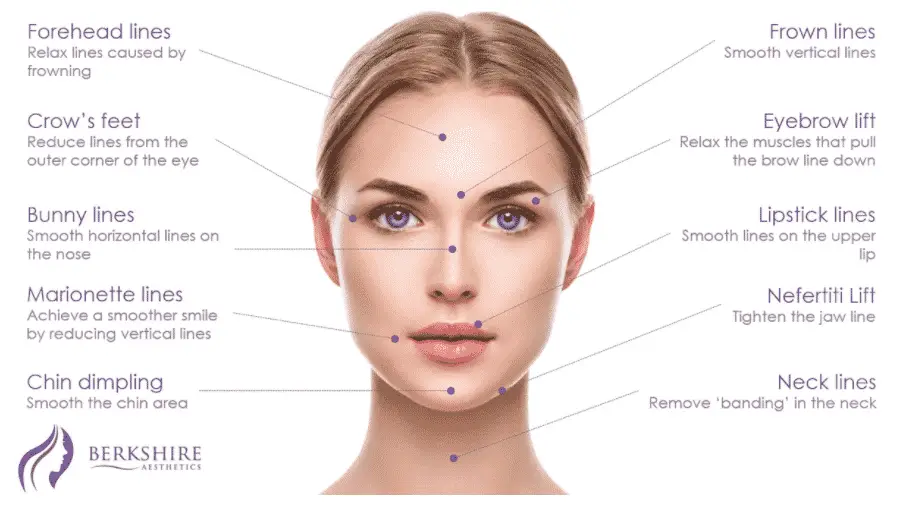 Anti-Wrinkle Injection Areas