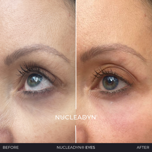 Nucleadyn-Eyes-Before-After-Results-01