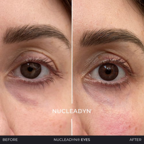 Nucleadyn-Eyes-Before-After-Results-02