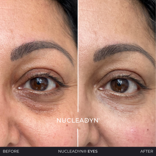 Nucleadyn-Eyes-Before-After-Results-03
