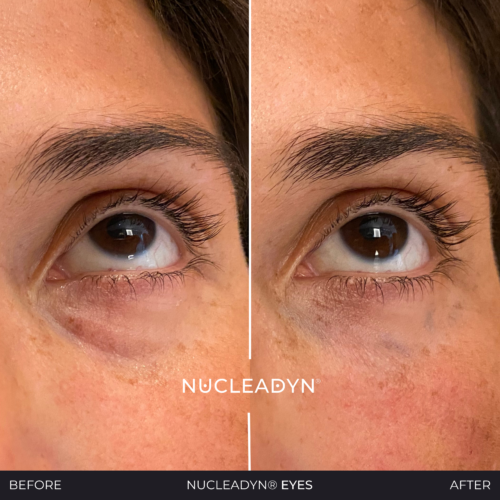 Nucleadyn-Eyes-Before-After-Results-04