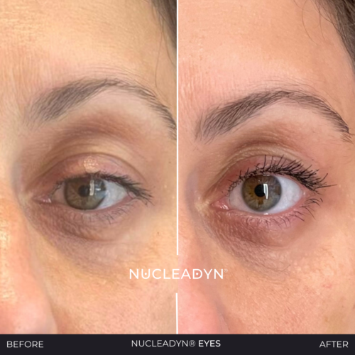 Nucleadyn-Eyes-Before-After-Results-06