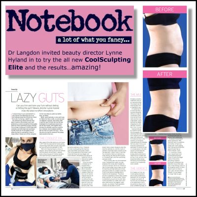 CoolSculpting Article in Notebook Magazine